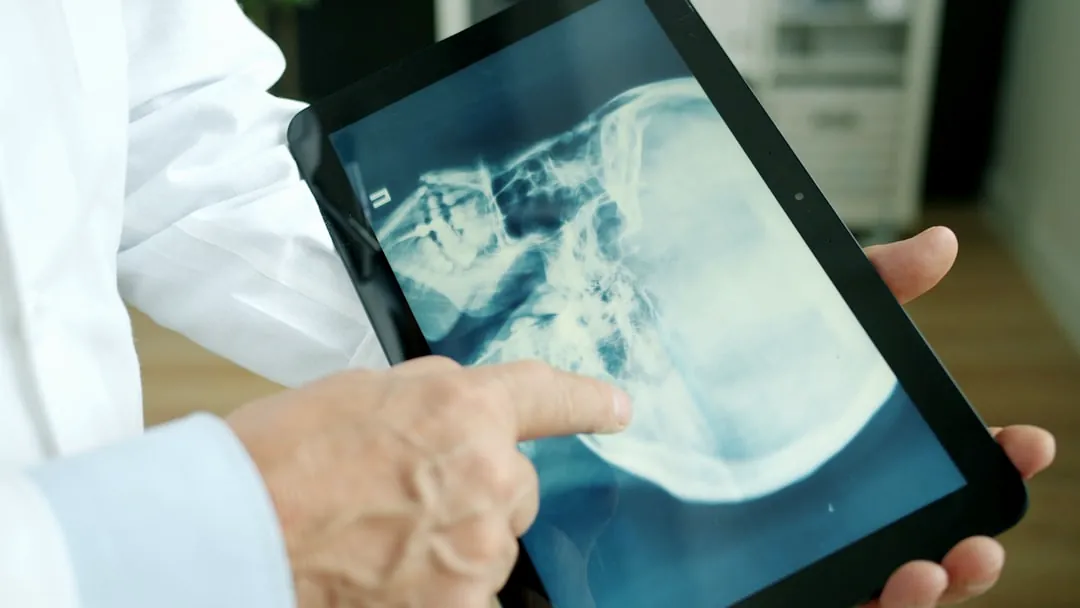 Doctor pointing at x-ray on tablet screen